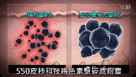 激光美容