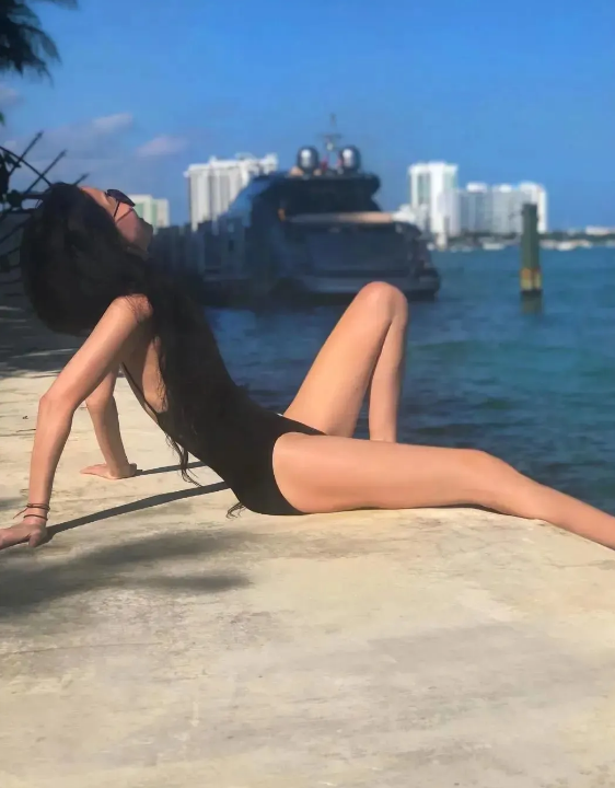 大腿吸脂减肥好不好