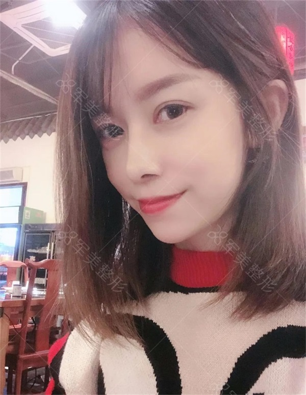 隆鼻哪种好