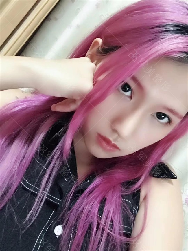 王世虎隆鼻隆的怎么样