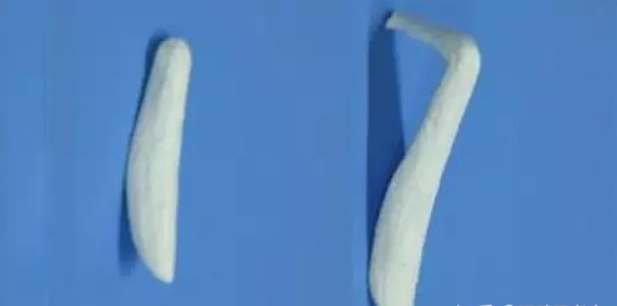 假体隆鼻