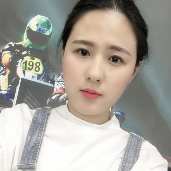 全切双眼皮好不好_姑娘做完双眼皮后..