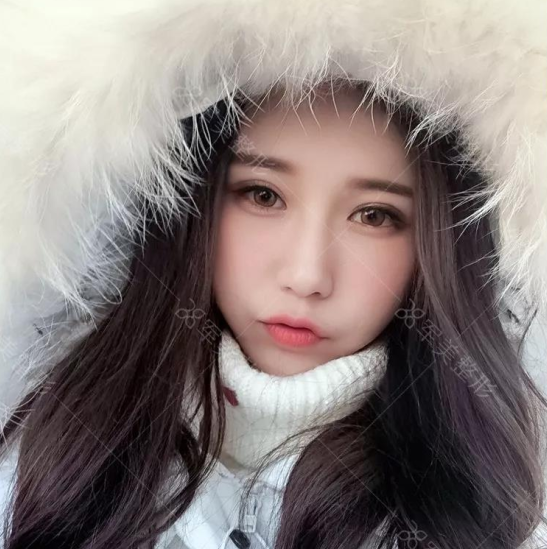 你知道吗?玻尿酸也分大中小!