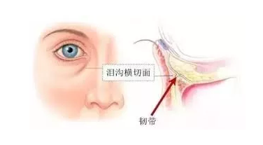 泪沟是怎么形成的