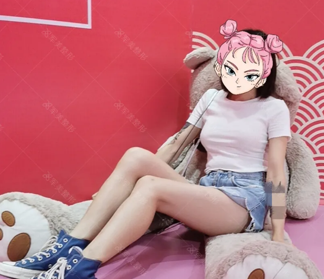 假体隆胸