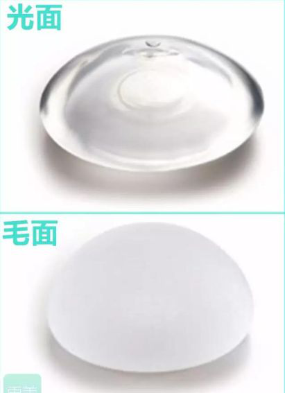 假体隆胸