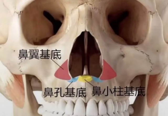 鼻基底凹陷的现象