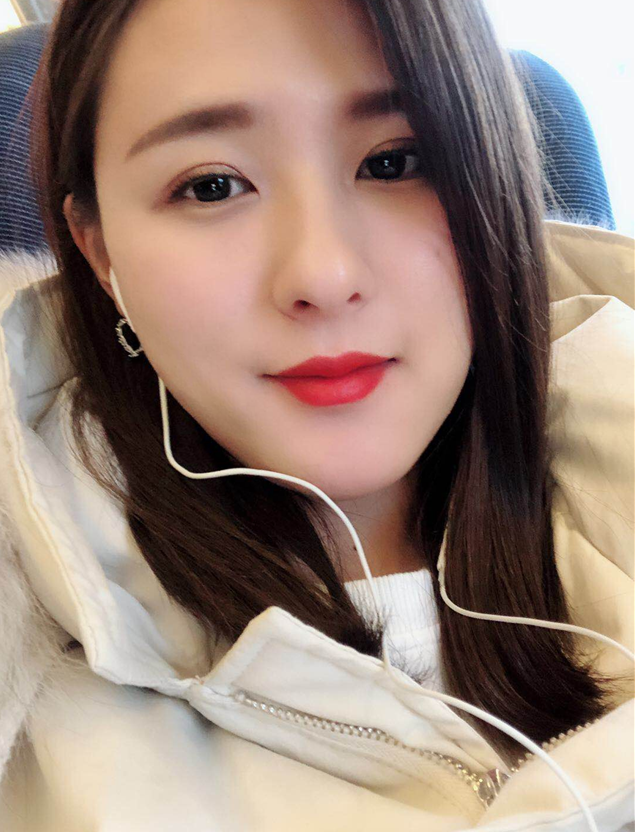 自体脂肪填充效果图