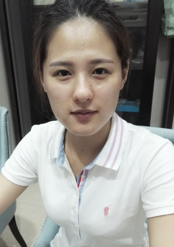 自体脂肪填充效果图