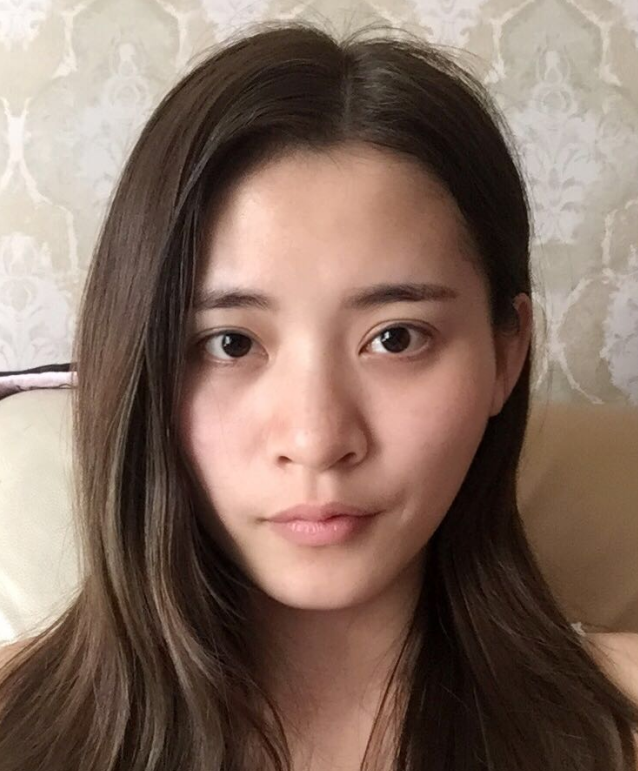 隆鼻哪种好