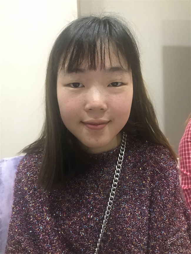 割双眼皮哪里好