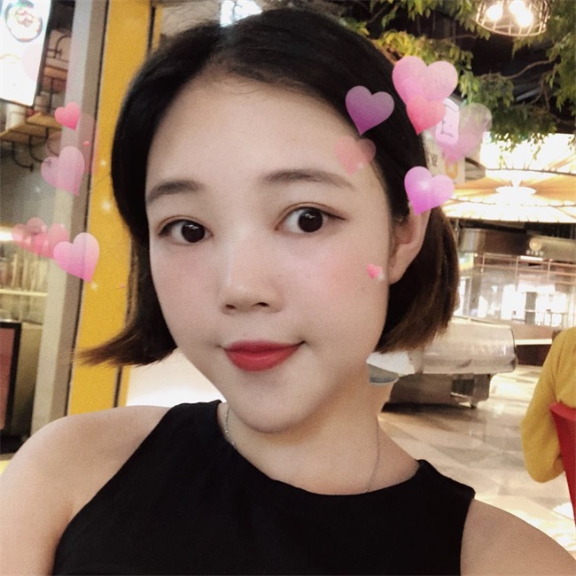 割双眼皮案例
