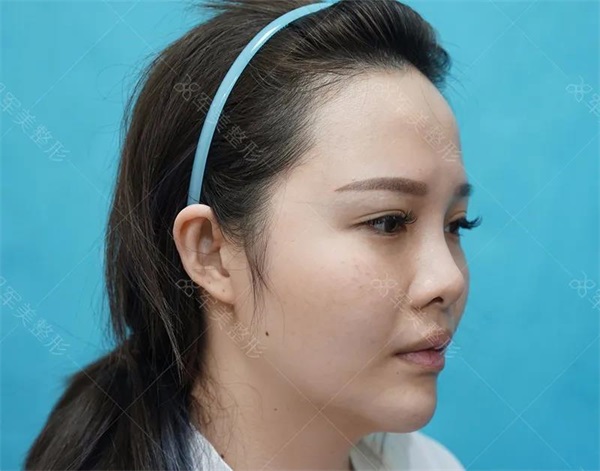 肋骨鼻综合案例