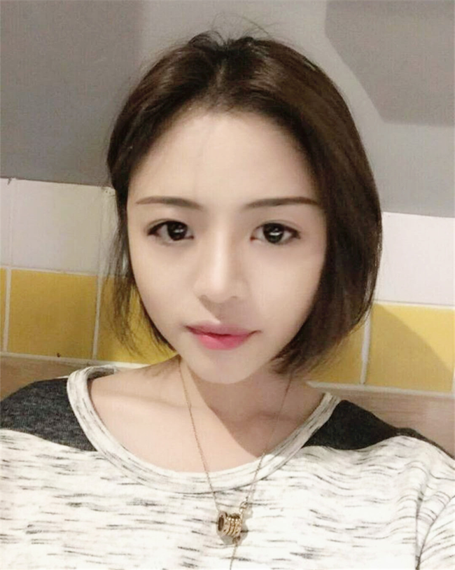 做隆鼻好吗