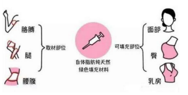 抽脂去哪里好