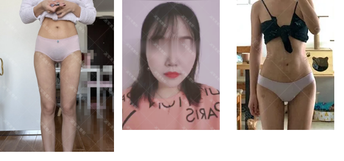 抽脂哪里做的好