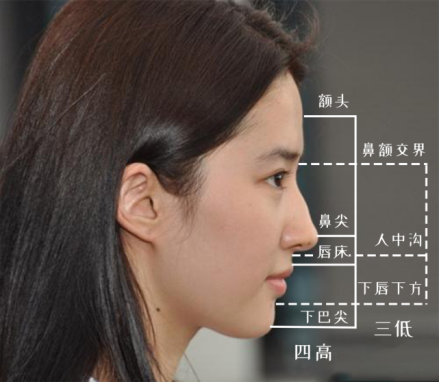 隆鼻手术图片