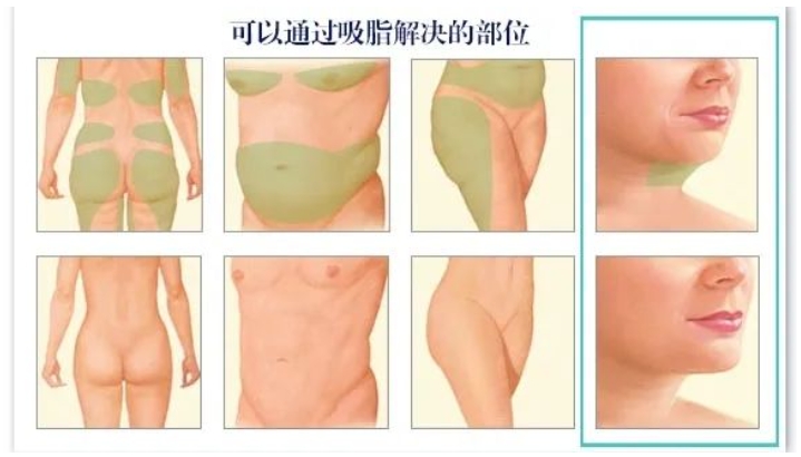 小v脸