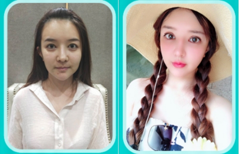 20多岁的姑娘既然衰老成30+_广州军美医疗美容医院