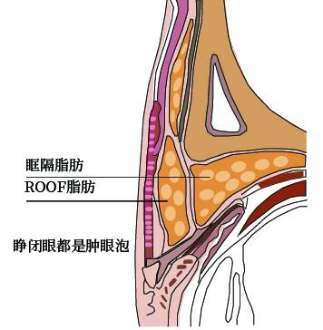 单眼皮怎么可以变双眼皮