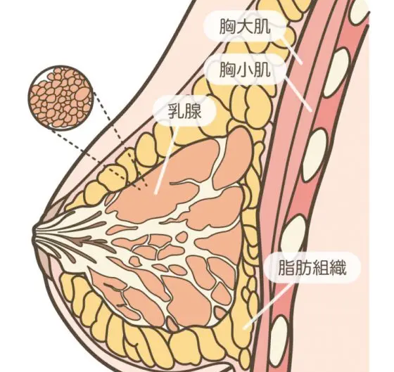 假体隆胸手感很假吗