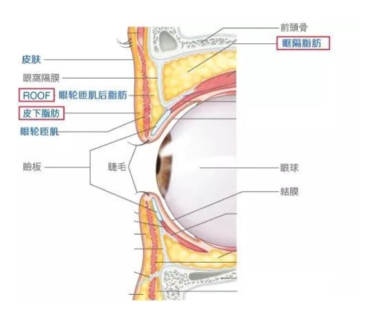 肿泡眼是什么样子的