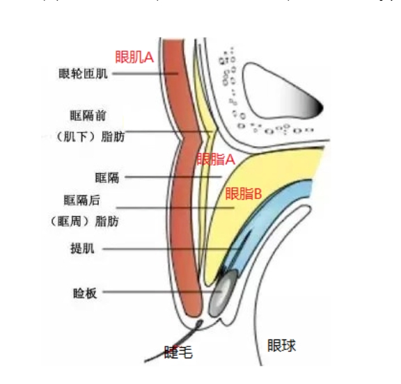 肿泡眼怎样才能彻底消除