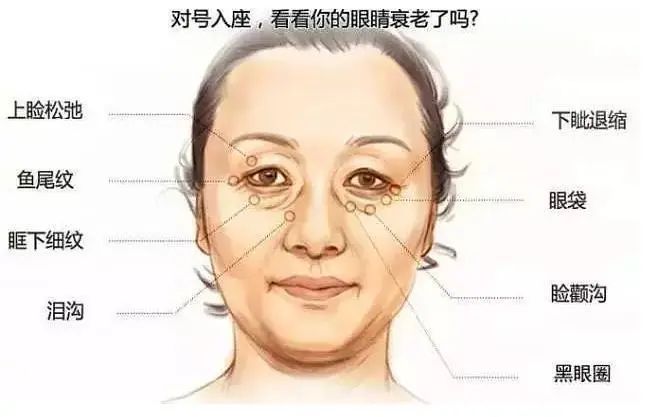 眼周衰老医美解决方案