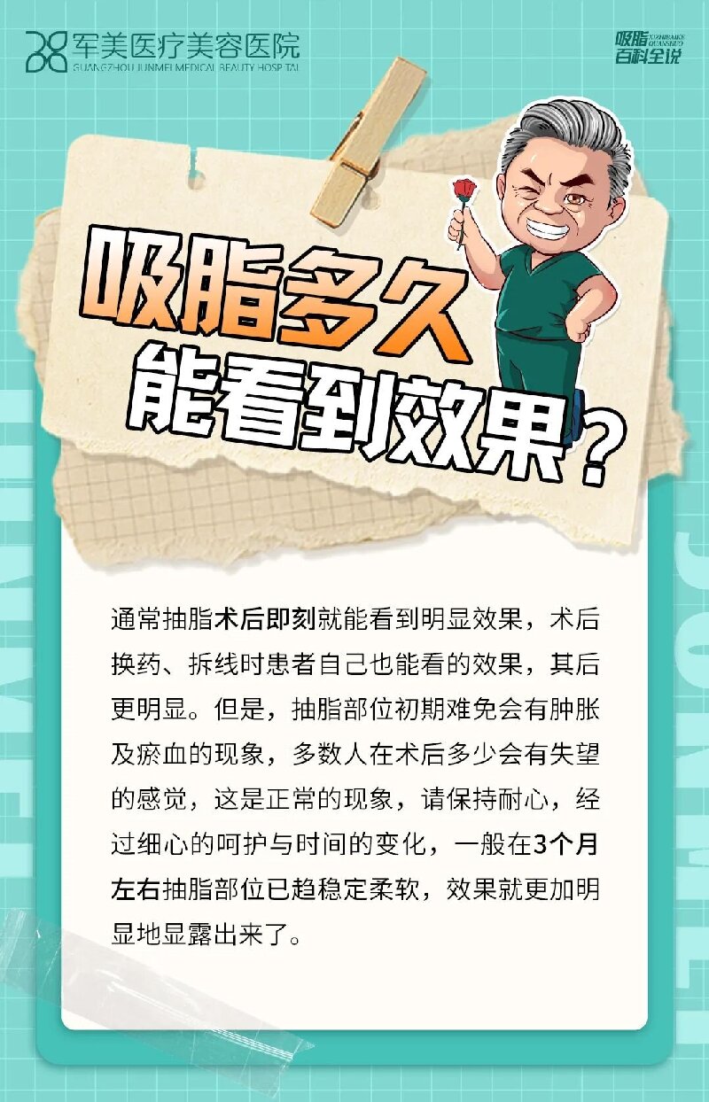 吸脂后多久才会瘦