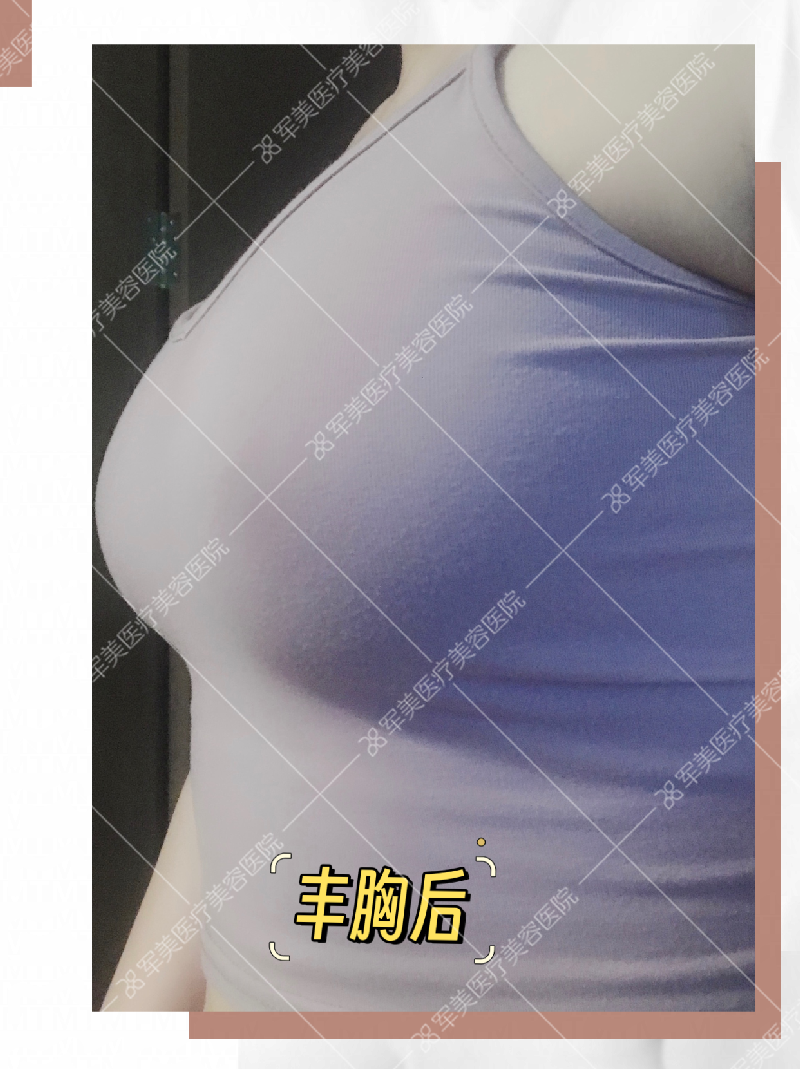 胸小怎么变大