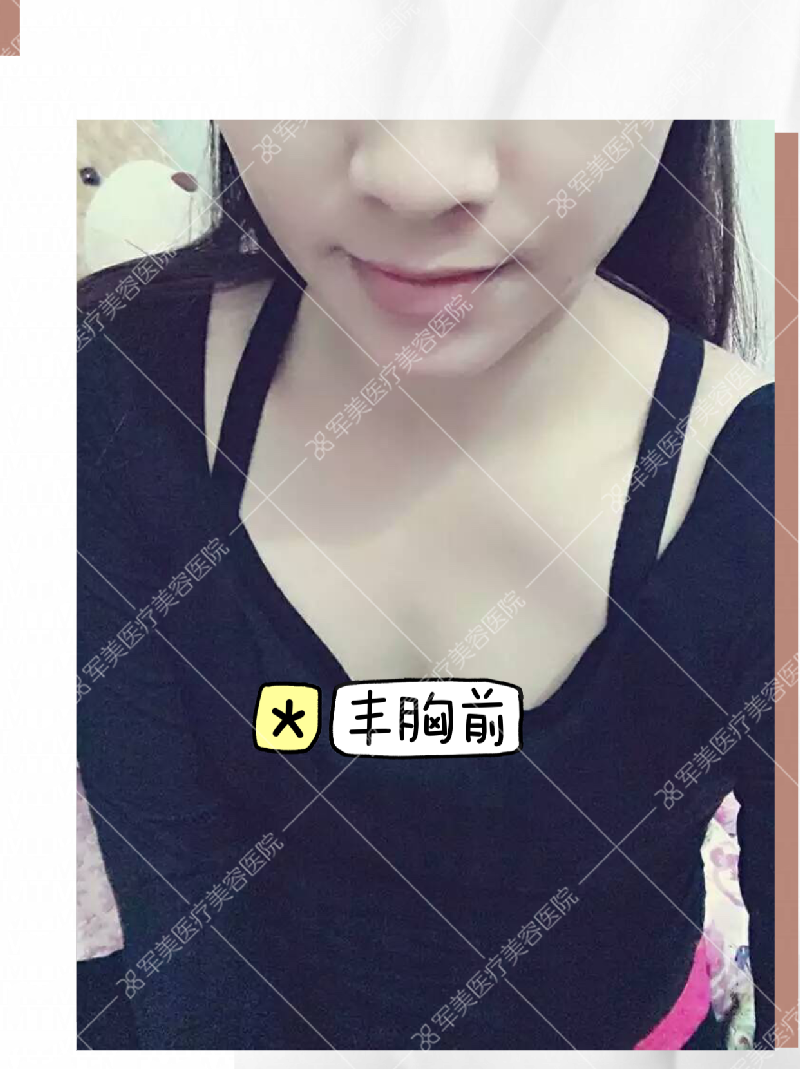 胸小怎么办能变大呢
