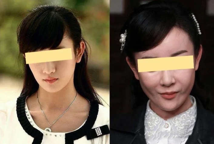 寿星额头的女明星