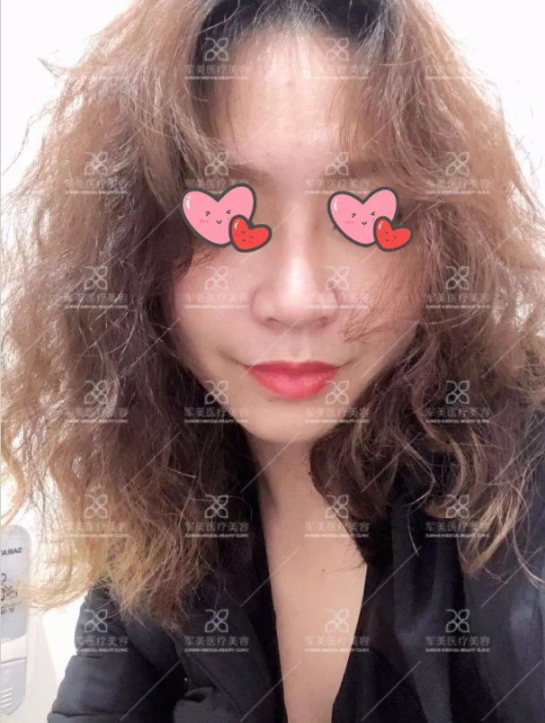 广州军美郑院案例