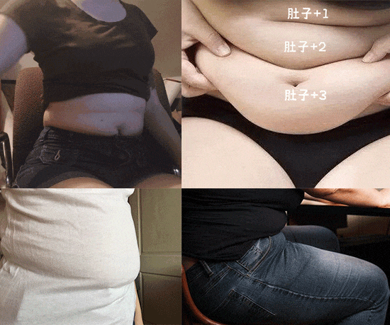腰腹吸脂后多久消肿