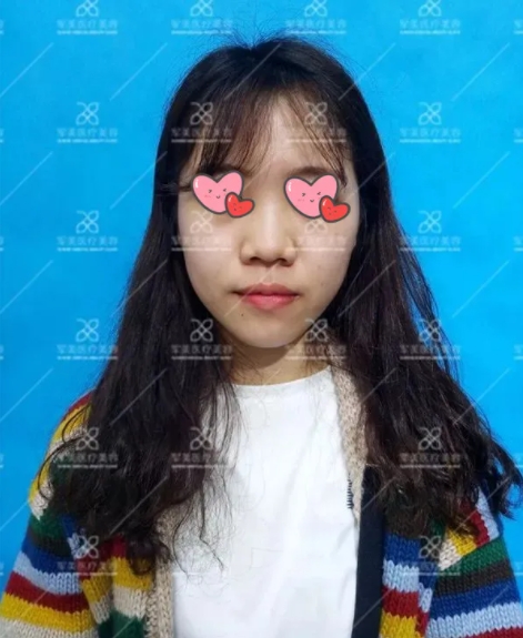 耳软骨鼻综合医生推荐
