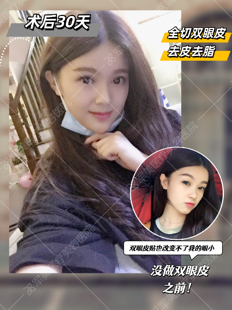郑少雄医生案例