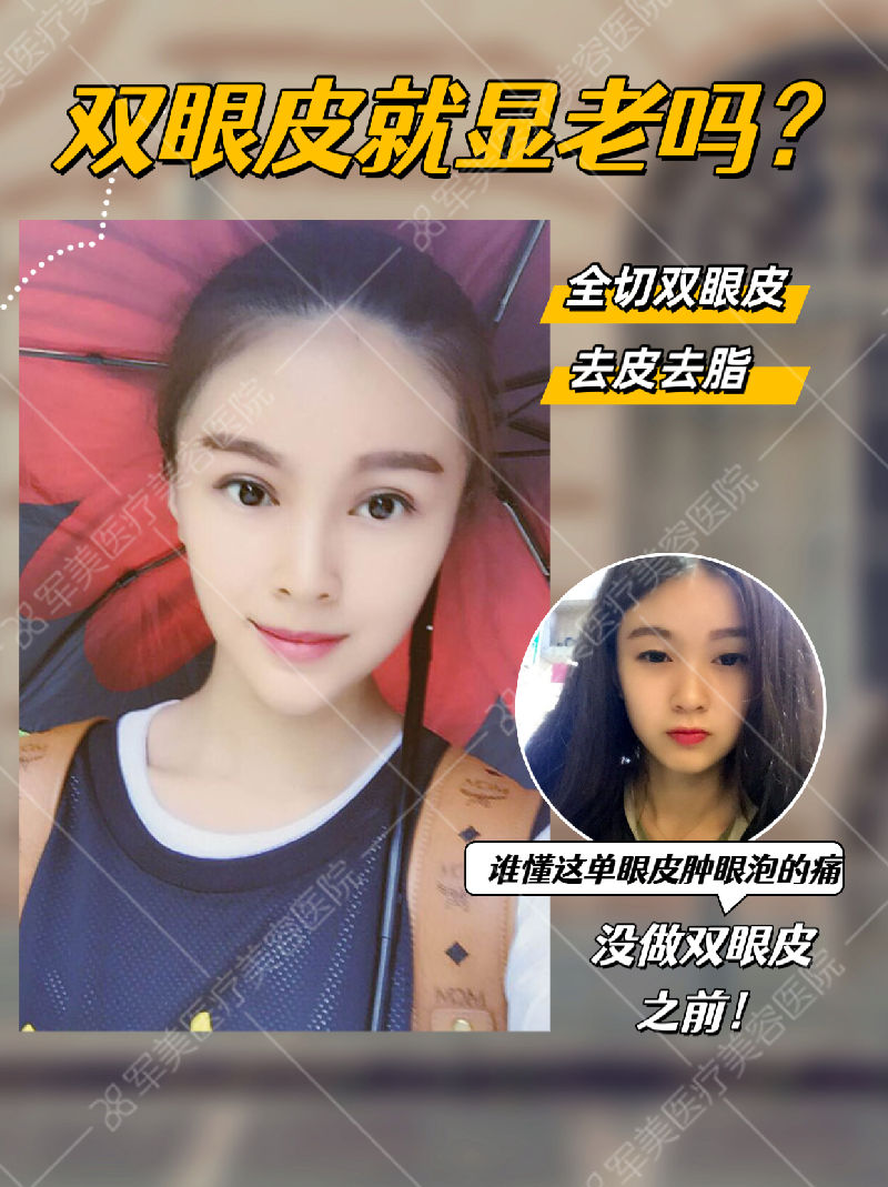 郑少雄医生案例