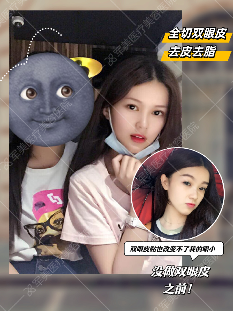 郑少雄医生案例