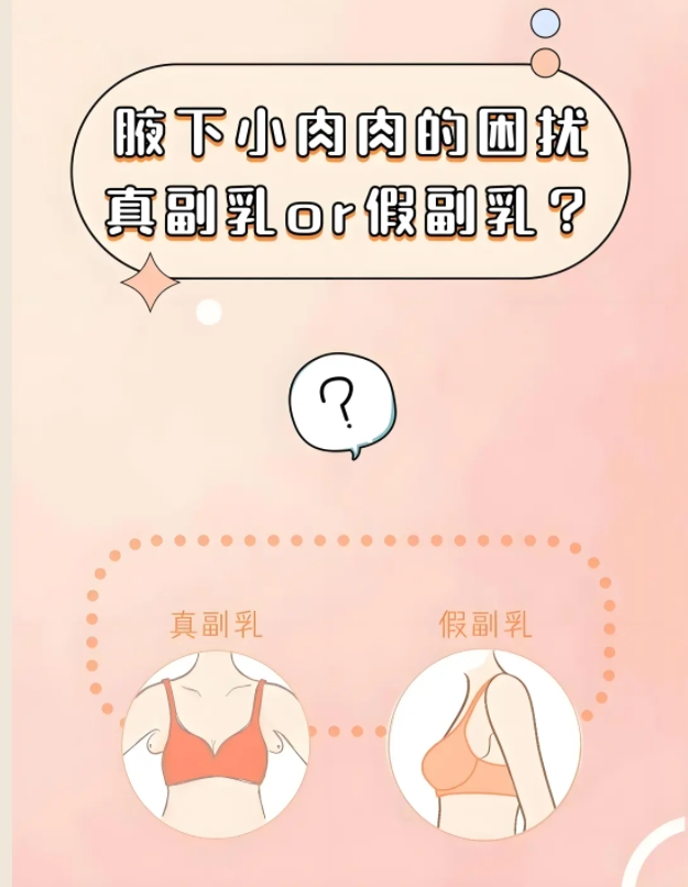 副乳怎么去除