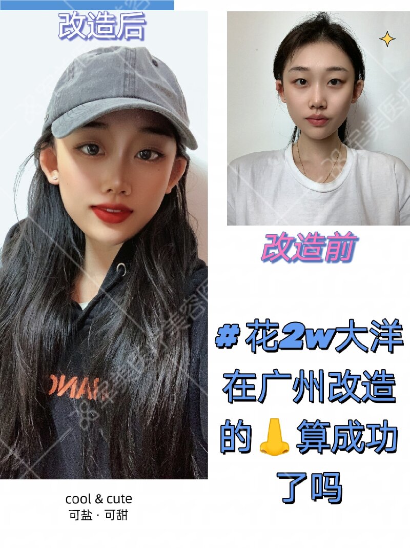 鼻修复哪个医生做得好