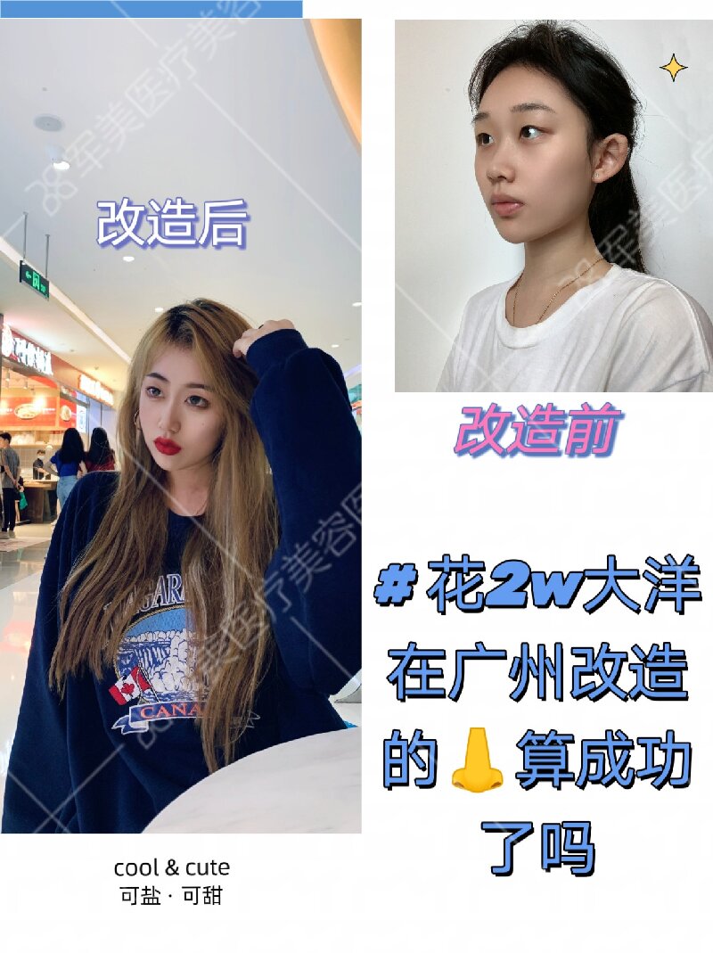 鼻修复哪个医生做得好