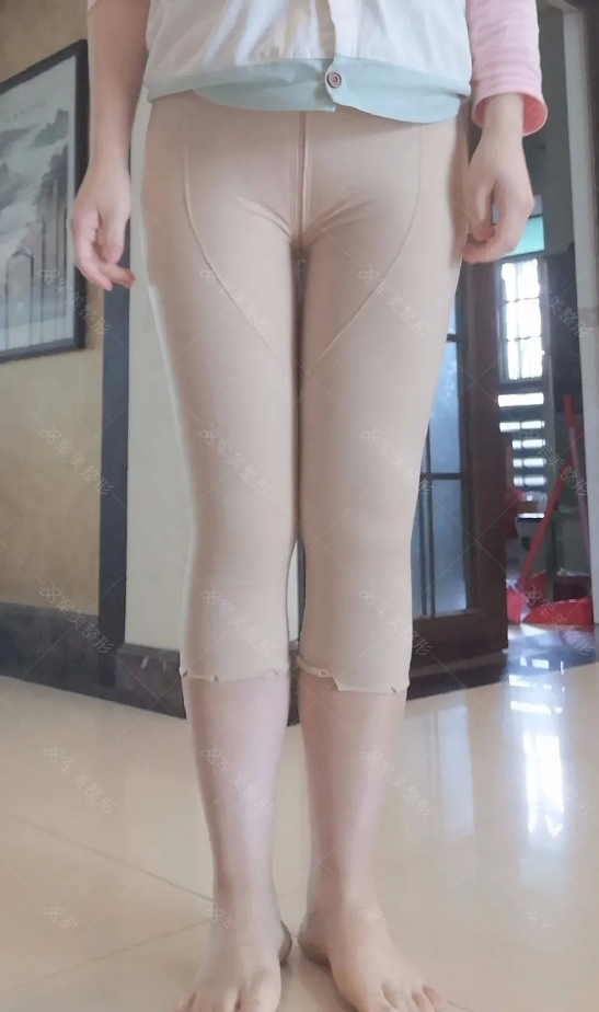 广州吸脂好的医院