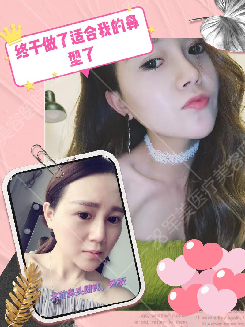 鼻修复哪个医生做得好