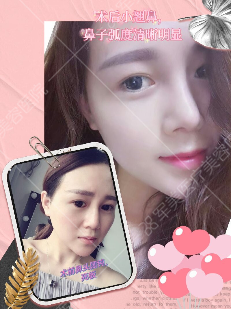 鼻修复哪个医生做得好