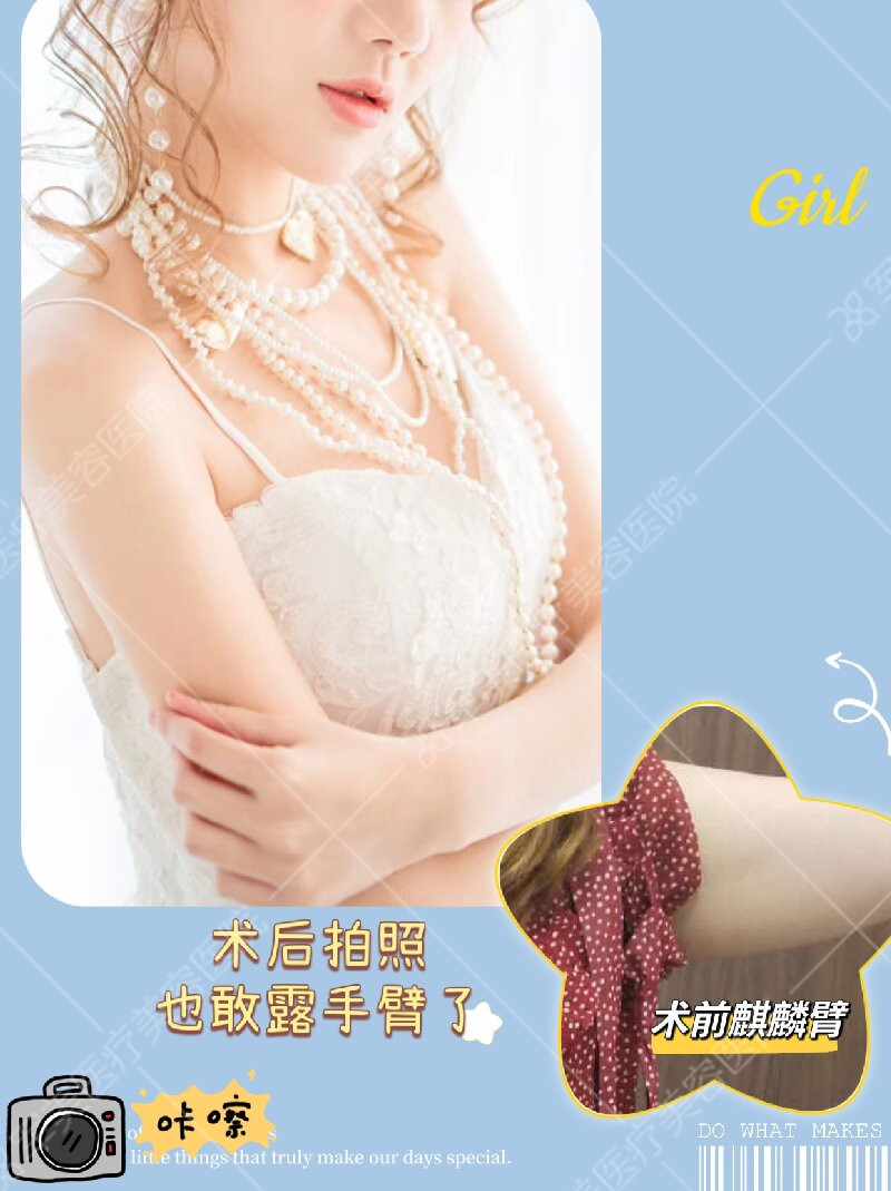 广州手臂抽脂哪里好