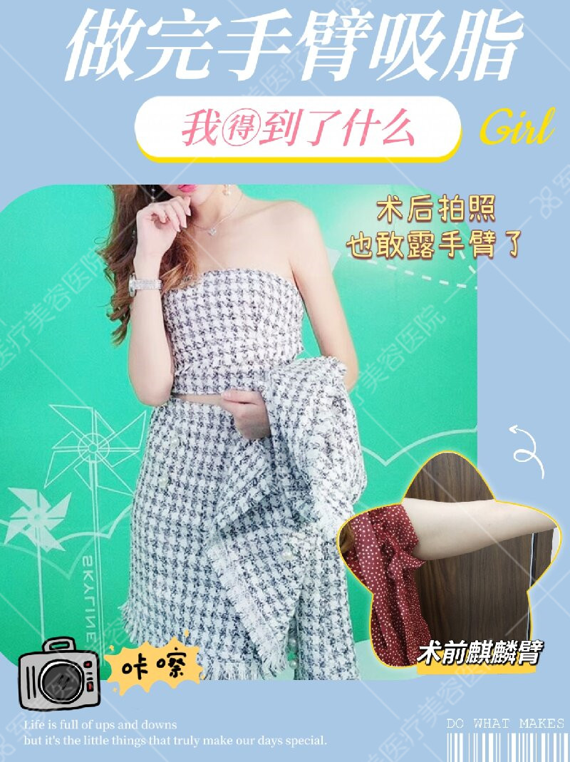 广州手臂抽脂哪里好