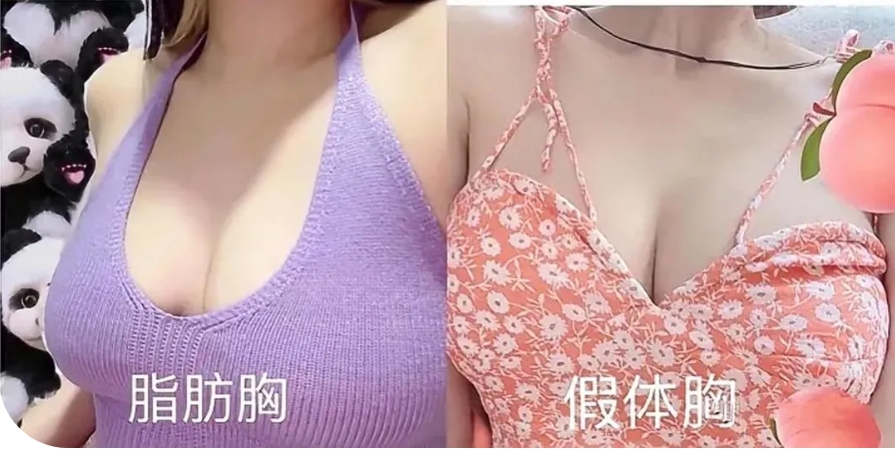 王世虎隆胸案例