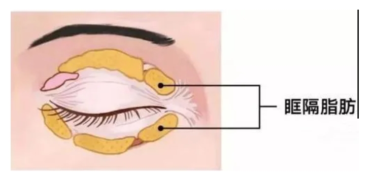 广州割双眼皮哪个医院最好