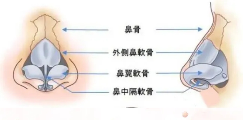 鼻头大怎么改善