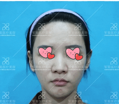 广州鼻子整形医院哪家好